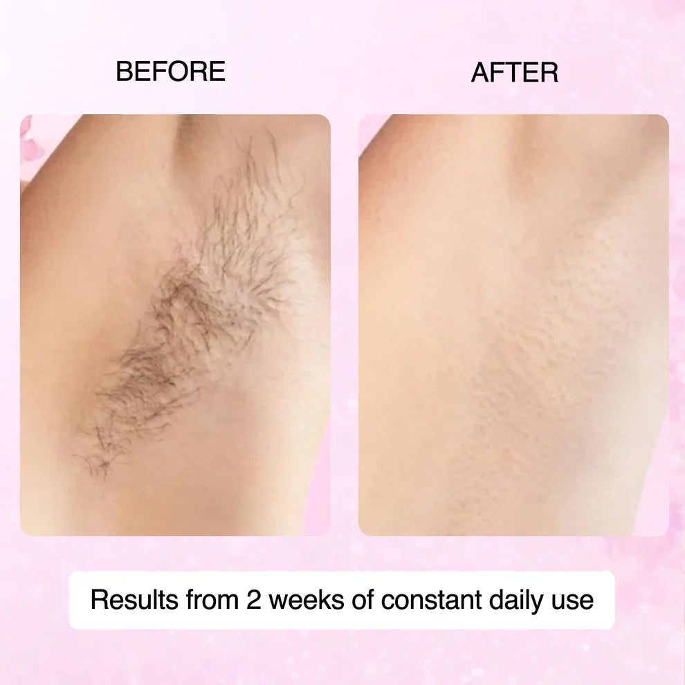 100% Natural Cyperus Rotundus Skin Serum