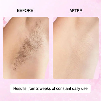 100% Natural Cyperus Rotundus Skin Serum