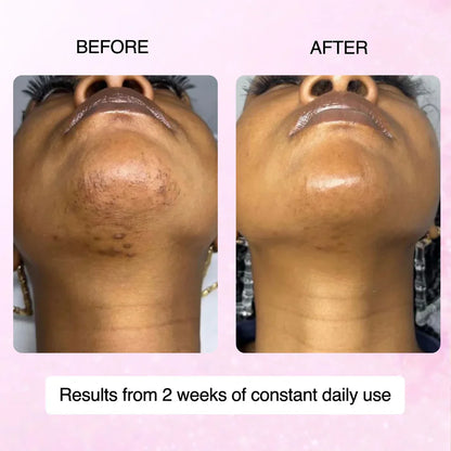 100% Natural Cyperus Rotundus Skin Serum